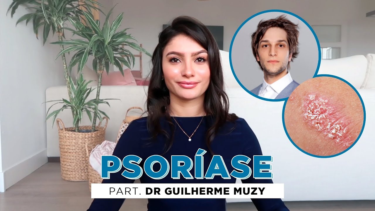 PSORÍASE Causa e Tratamento com Dr. Guilherme Muzy | Skinenthusiast |Thamires Nascimento