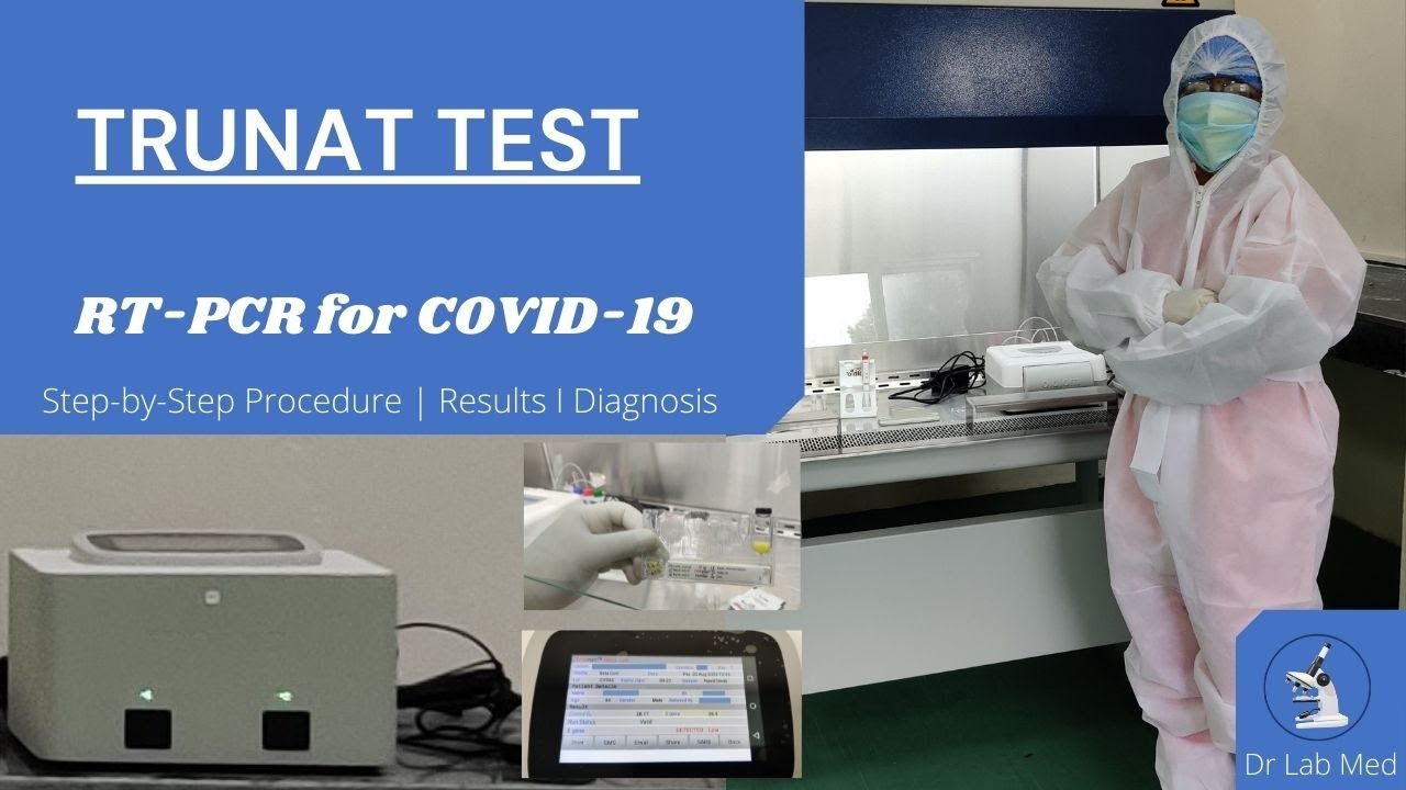 Corona Test: Truenat RT-PCR Test for Covid-19 | Procedure | Diagnosis