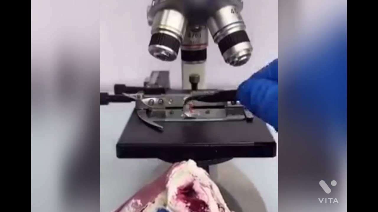 Birthday Cake view in microscope 😭😭😭