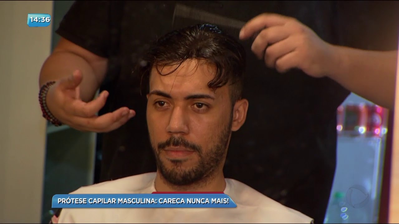 BG - Prótese capilar masculina: Careca nunca mais! - 16-10-2017