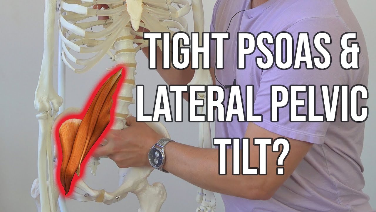 Lateral Pelvic Tilt and TIGHT PSOAS Exercises - 4-Step Progression