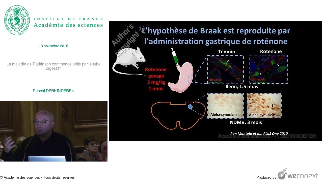 La maladie de Parkinson commence t-elle par le tube digestif? par Pascal DERKINDEREN