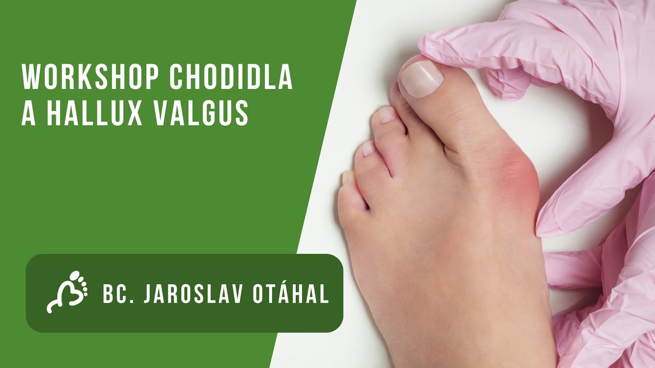 Online workshop chodidla a hallux valgus s Jaroslavem Otáhalem