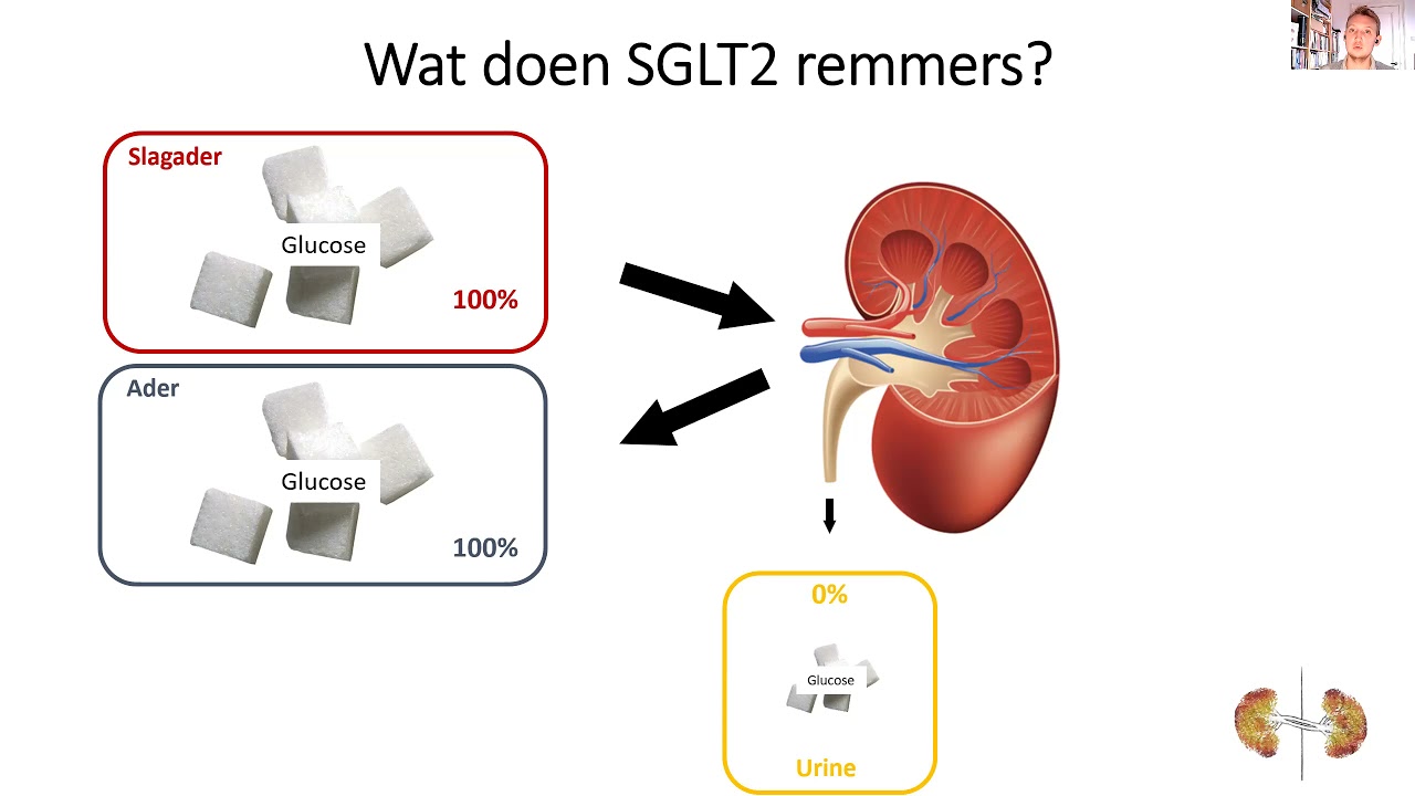 proefschrift uitgelegd: SGLT2-remmers, diabetes en nieren