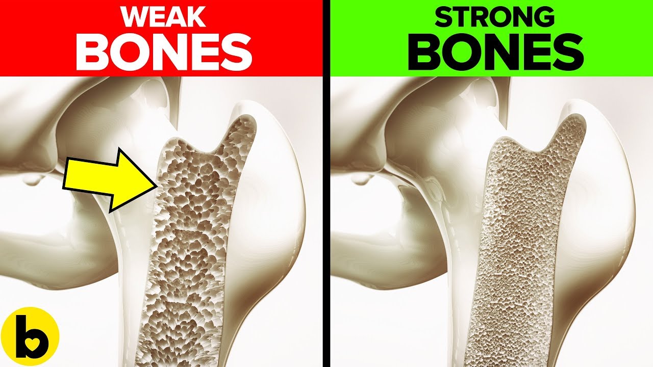 11 NATURAL Ways To Build & Strengthen HEALTHIER Bones
