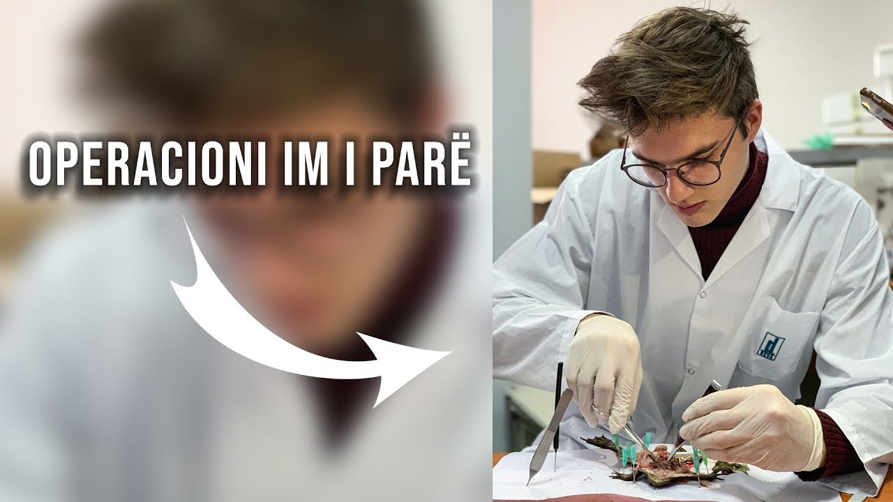 Operacioni im i Par&euml;!!| Loti Shaqiri