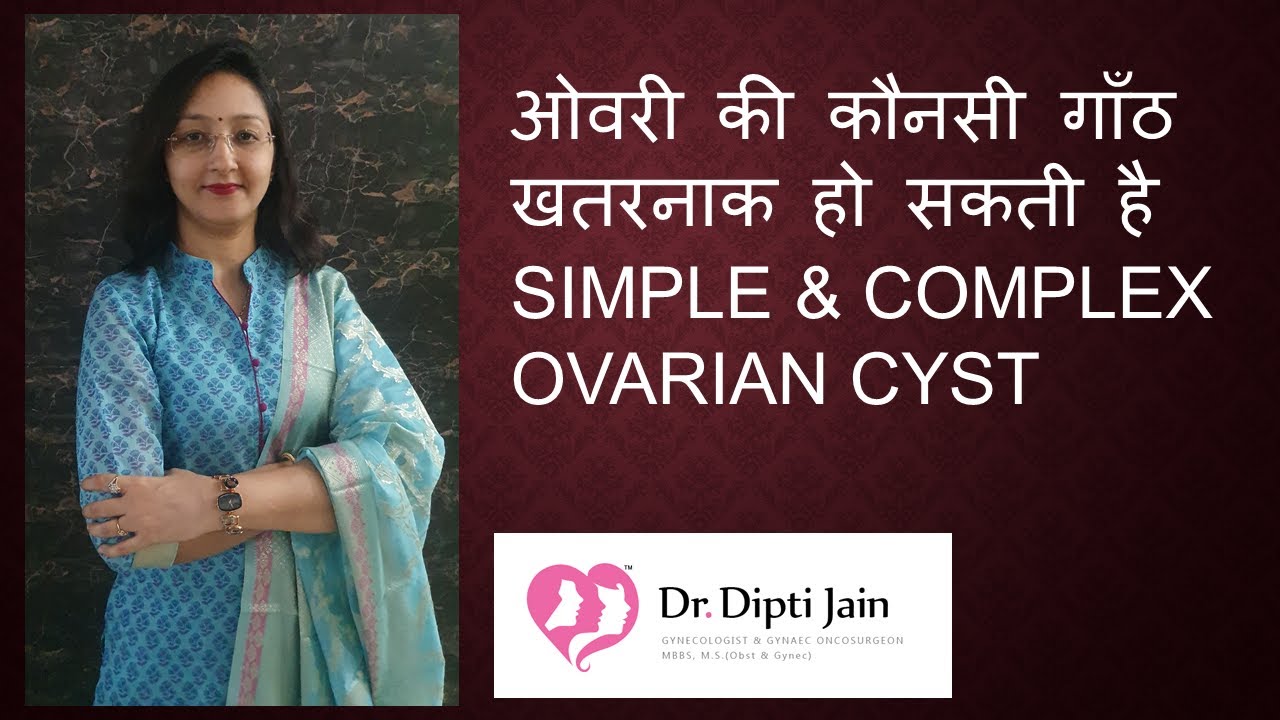 OVARIAN CYST - SIMPLE & COMPLEX ओवरी की गाँठ Which one is dangerous ?