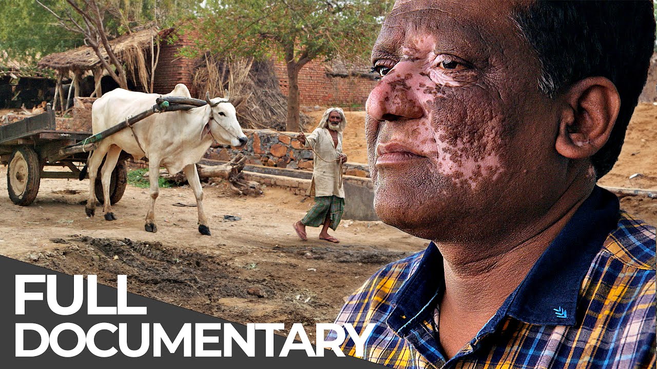 Extreme India: Cow Vigilantes, Disabled Dating & More | Unreported World | Free Documentary