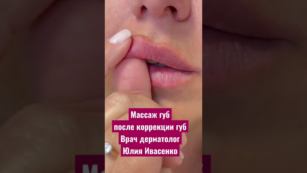 Правильный массаж губ после введения гиалуроновой кислоты в технике #плоскийбант