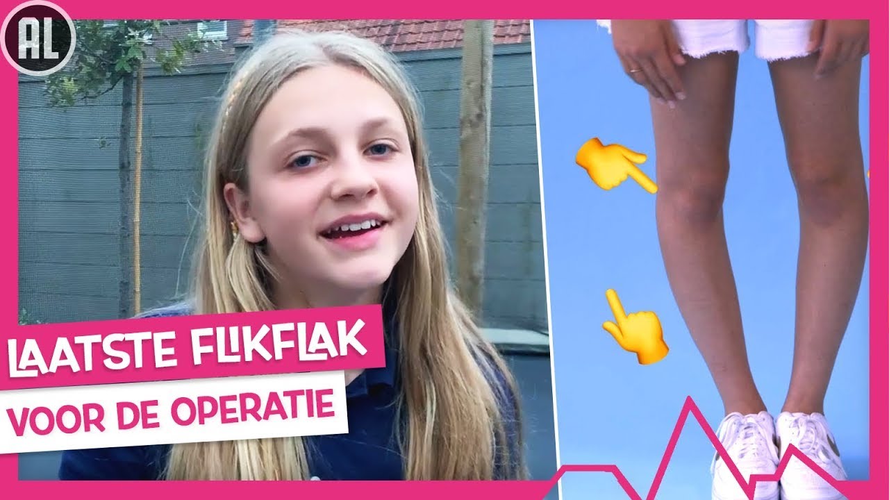 YANA'S BENEN WORDEN RECHTGEZET 🦵 | TOPDOKS NET FF ANDERS