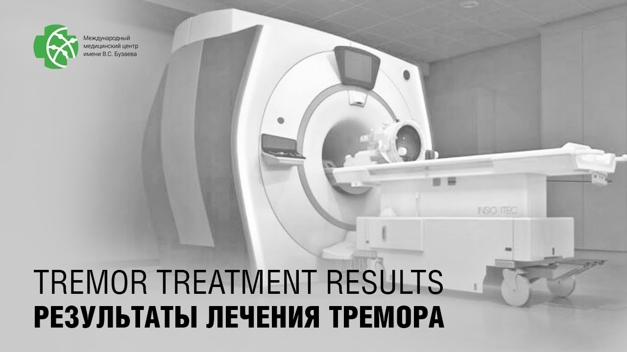 Результаты лечения тремора правой руки методом МР-ФУЗ