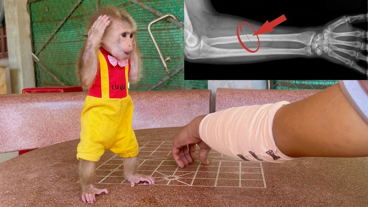 Lulu Is Shocked to Hear Dad’s Arm Is Seriously Hurt