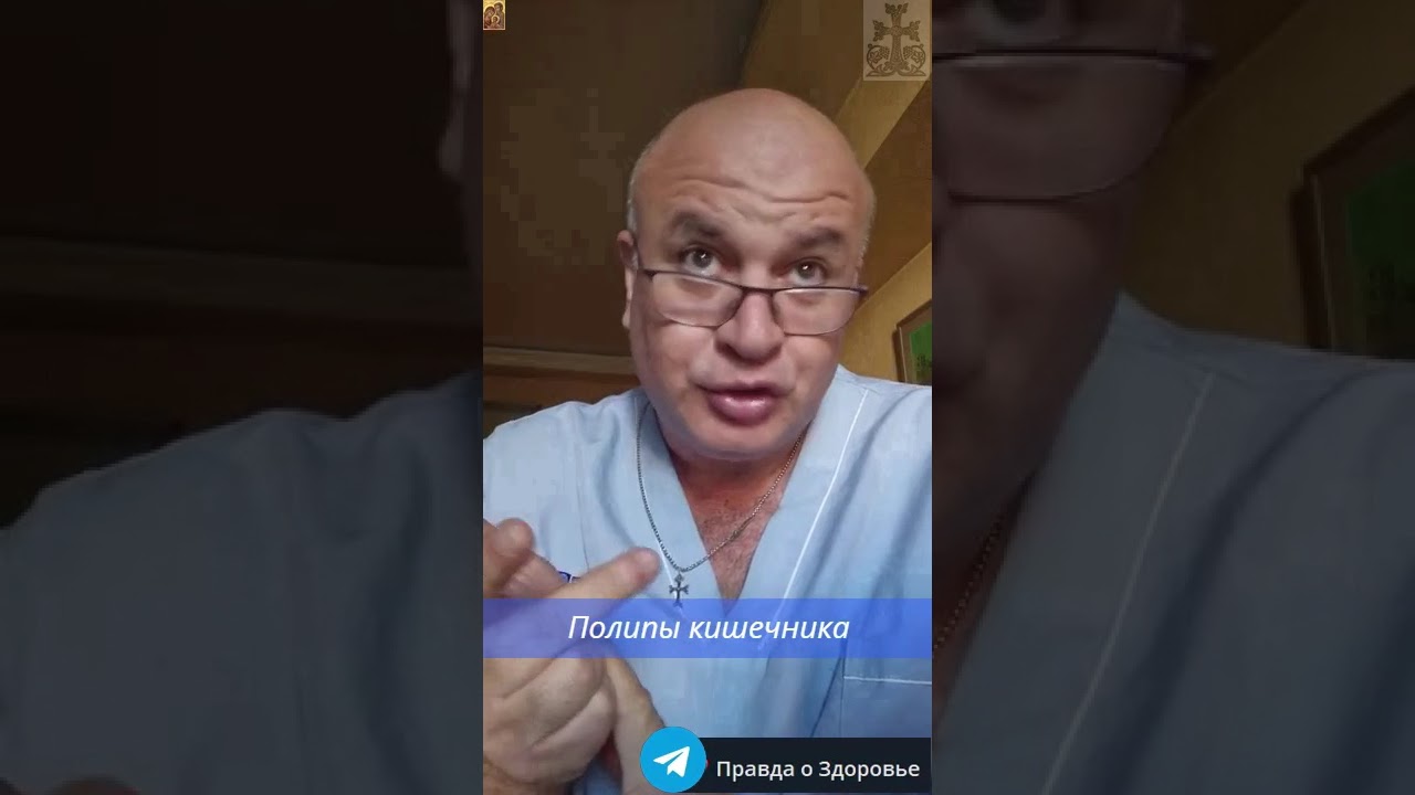 Полип кишечника: маленький засранец большой проблемы