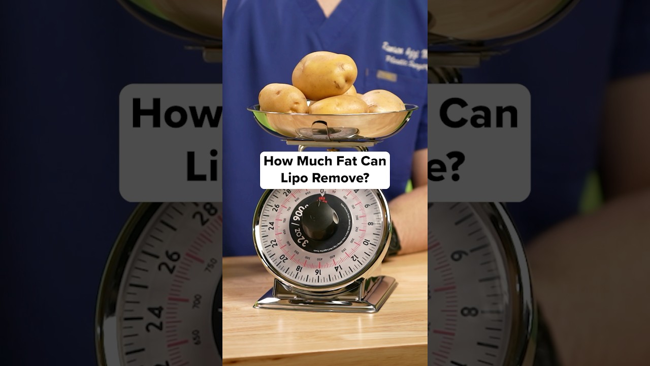 Plastic Surgeon Explains How Much Fat Liposuction Removes