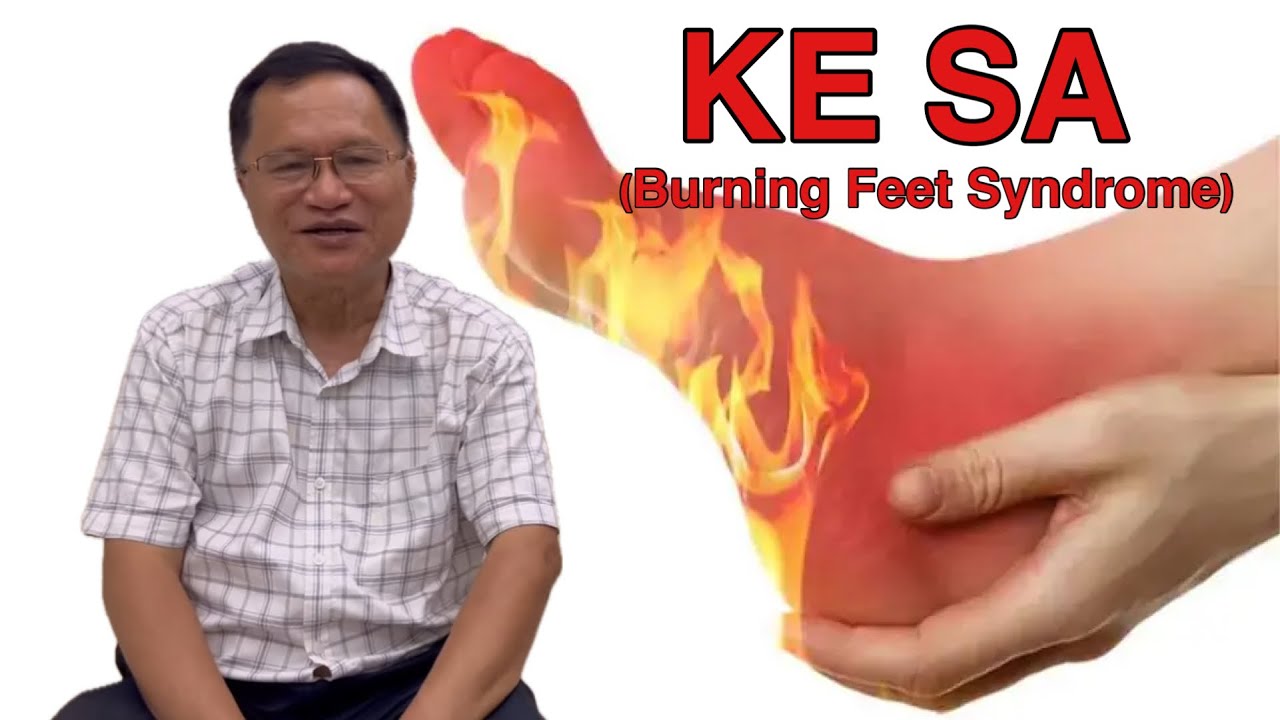 KE SA (Burning Feet Syndrome) #burningfeet  #burningsensation  #healthtips  #doctoradvice
