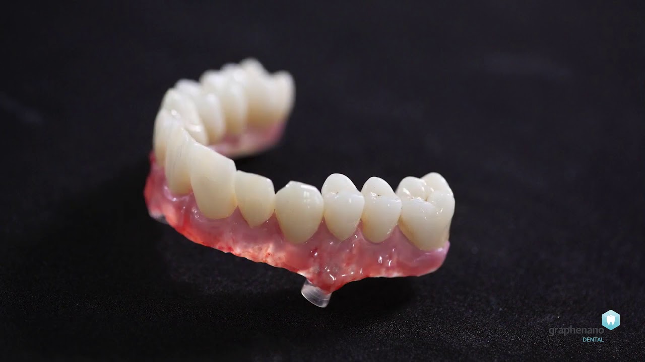 Graf&eacute;n Anatomikus fogp&oacute;tl&aacute;sok -  Graphenano dental - Digit&aacute;lis fogtechnika