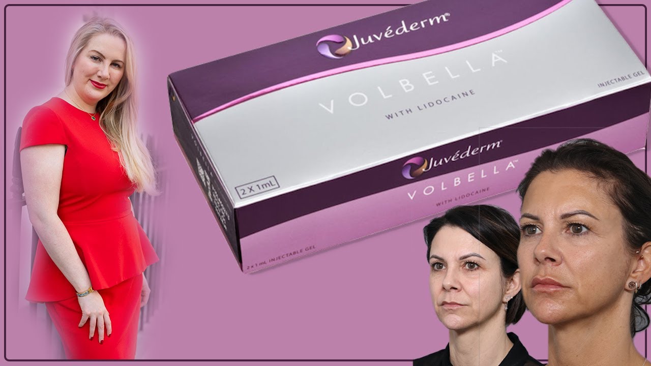 Lip Filler Juvederm Volbella With Before And After Pictures