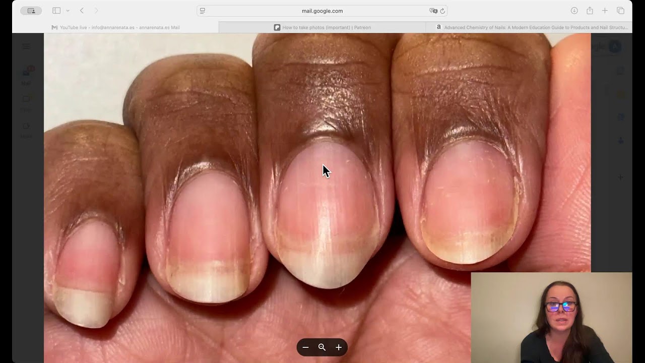 Send me your nail photos so I can assess them!