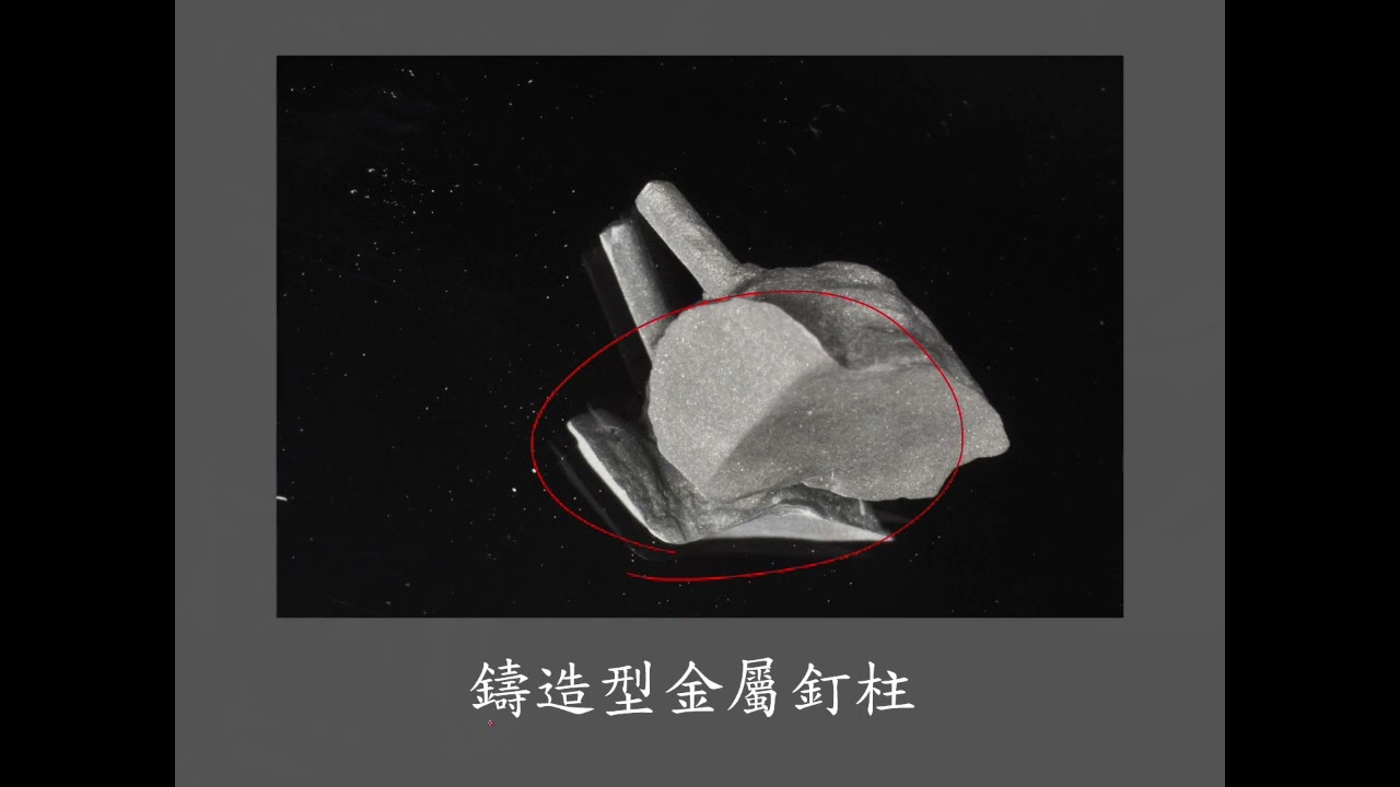 牙髓 牙周 膺復合併症 根尖病變 #46