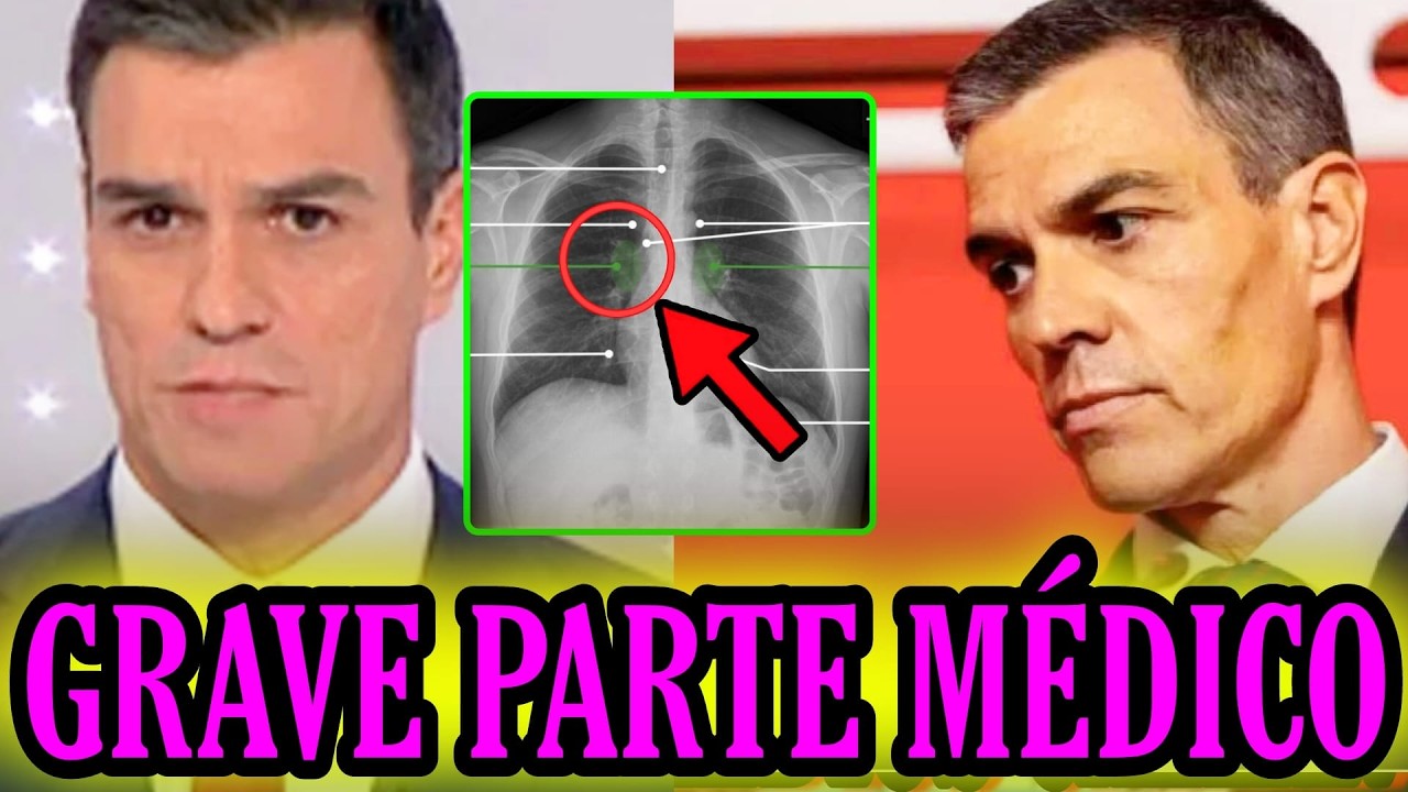 🚨ÚLTIMA HORA: FILTRAN la ENFERMEDAD de Pedro Sánchez y Moncloa MANDA COMUNICADO URGENTE