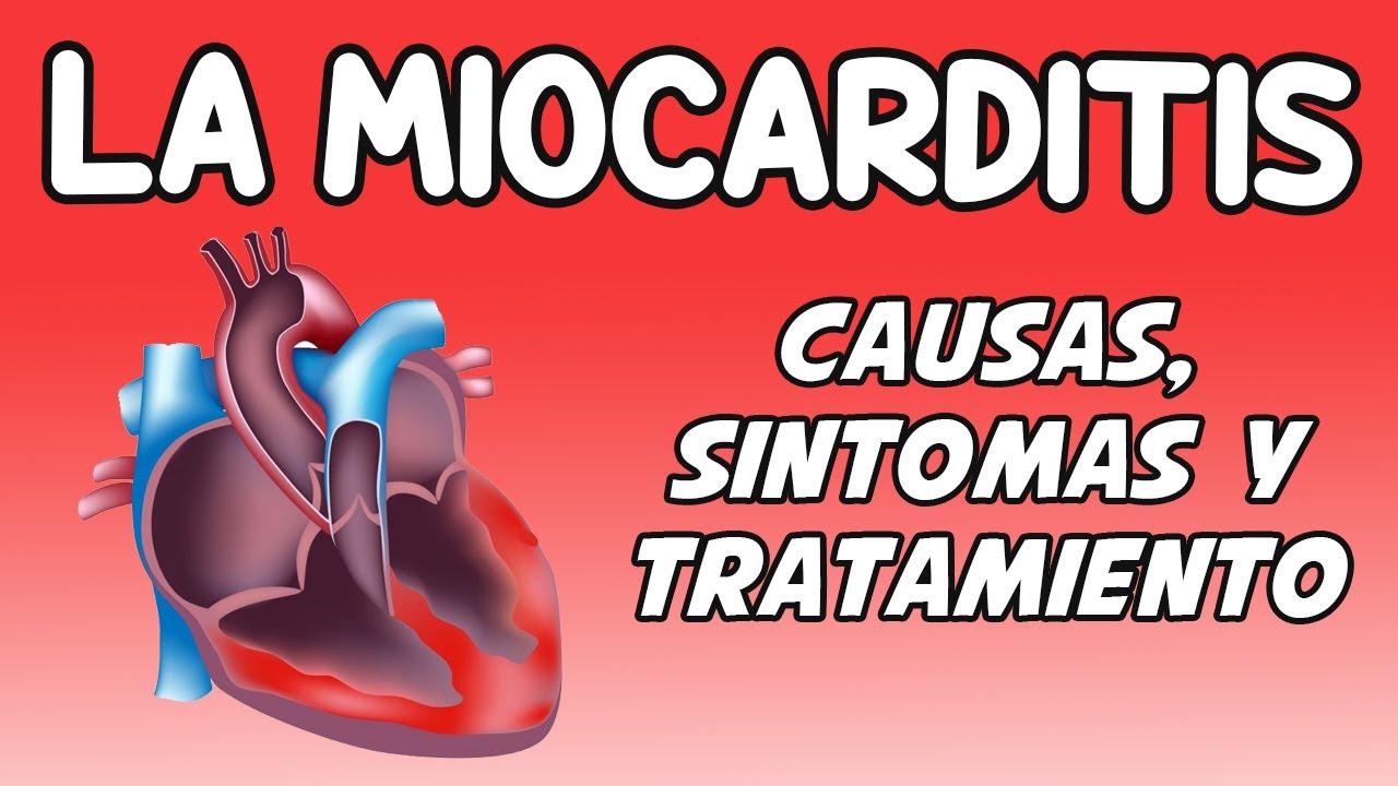 LA MIOCARDITIS,  Causas, síntomas, diagnóstico y tratamiento