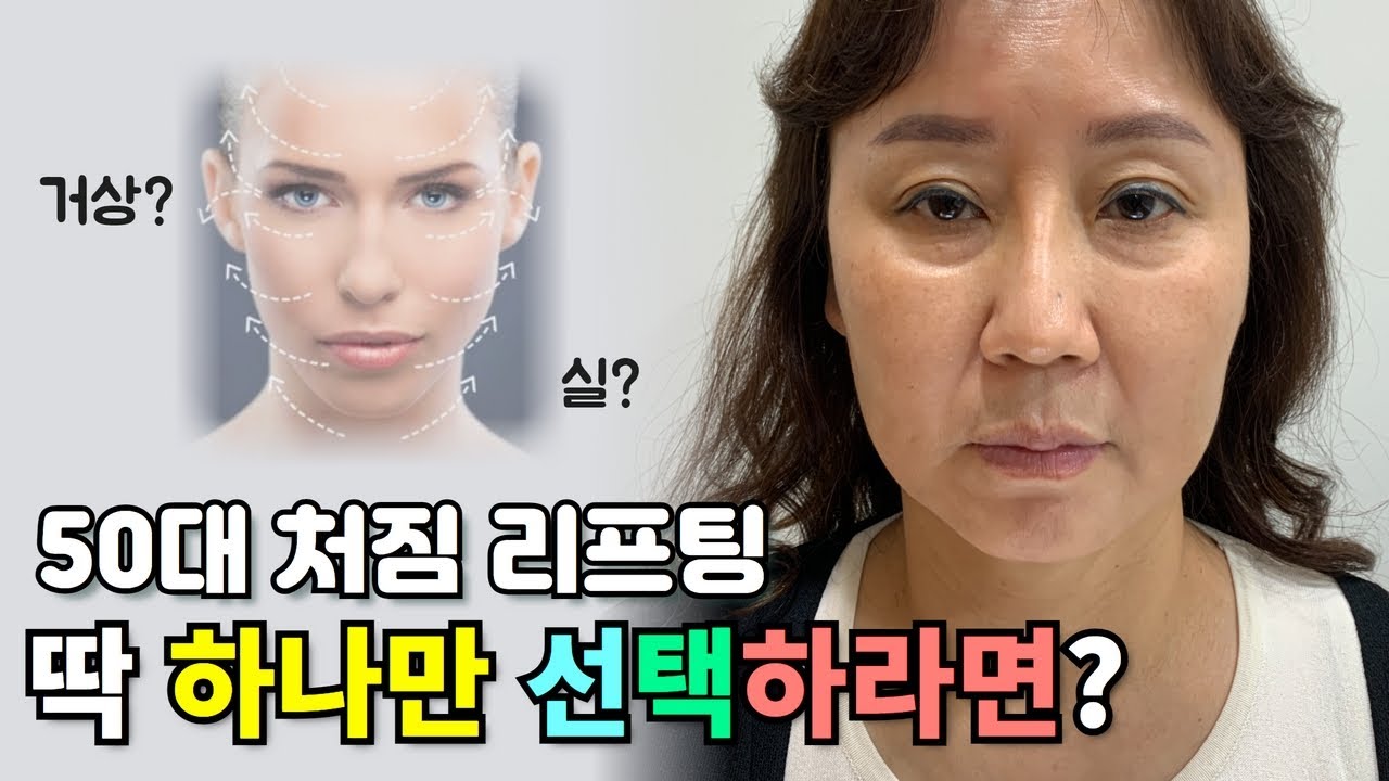 [ENG CC] 50대 피부 처짐 리프팅 딱 하나만 선택하라면? | 팔자주름, 얼굴처짐, 볼처짐, 심부볼, 얼굴라인|미니거상 솔직후기, 전후비교, 회복과정, 수술부기