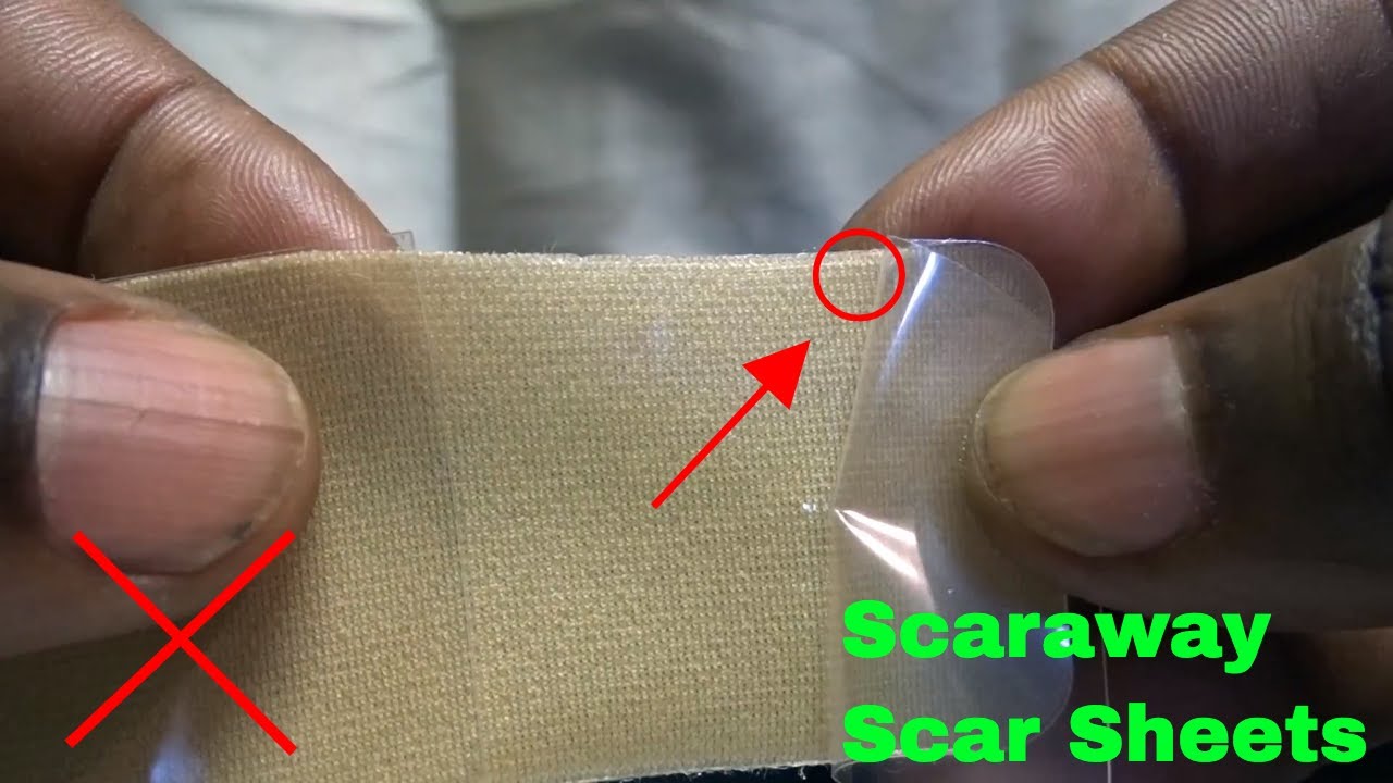 ✅ Как использовать силиконовые пластыри от шрамов Scaraway: обзор