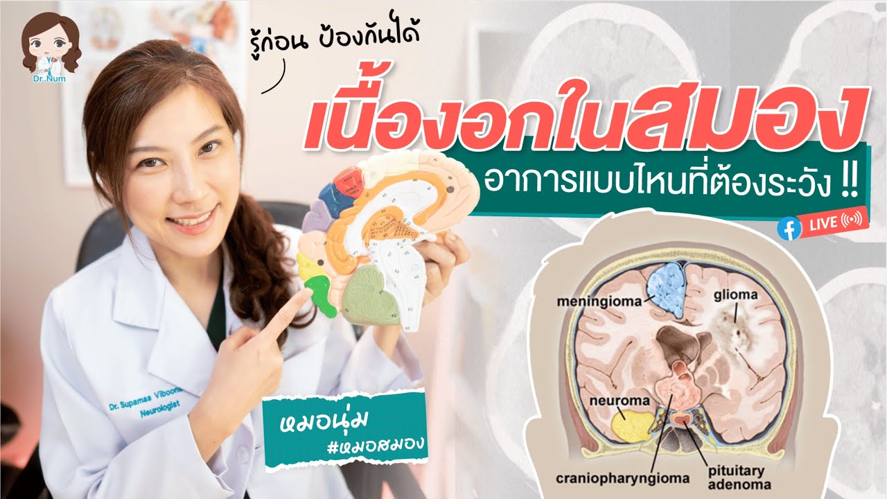 เนื้องอกในสมอง อาการแบบไหนที่ต้องระวัง?