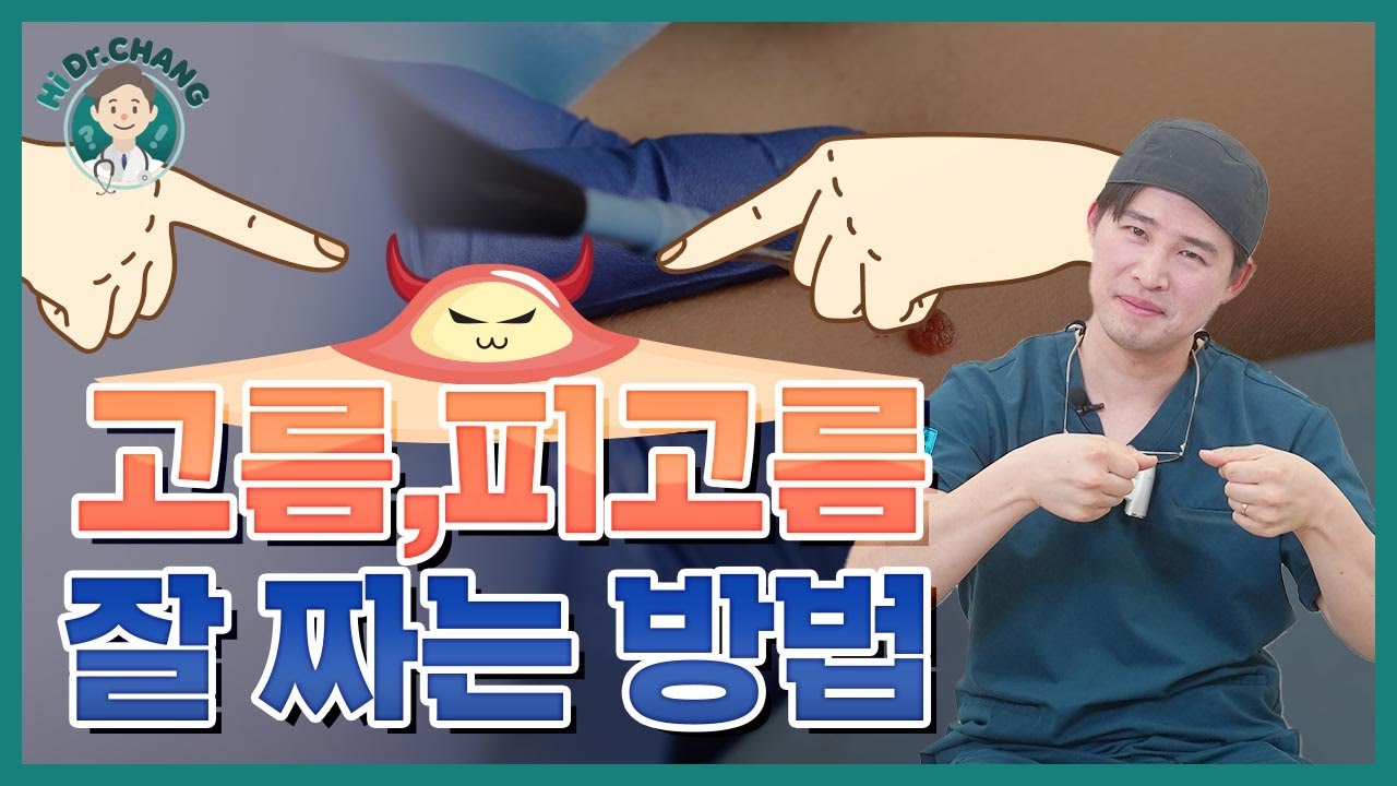 고름, 피고름 이렇게 짜셔야 합니다! 【건대성모외과의원】