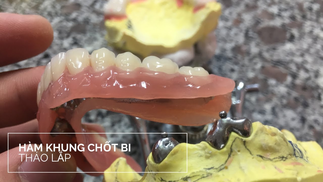 HÀM KHUNG CHỐT BI 