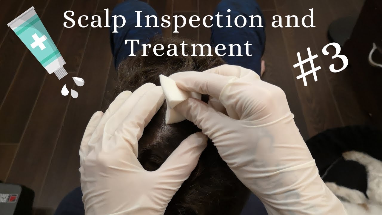 Real Person ASMR Scalp Check, Lice Check and Scalp Treatment #3 No Talking