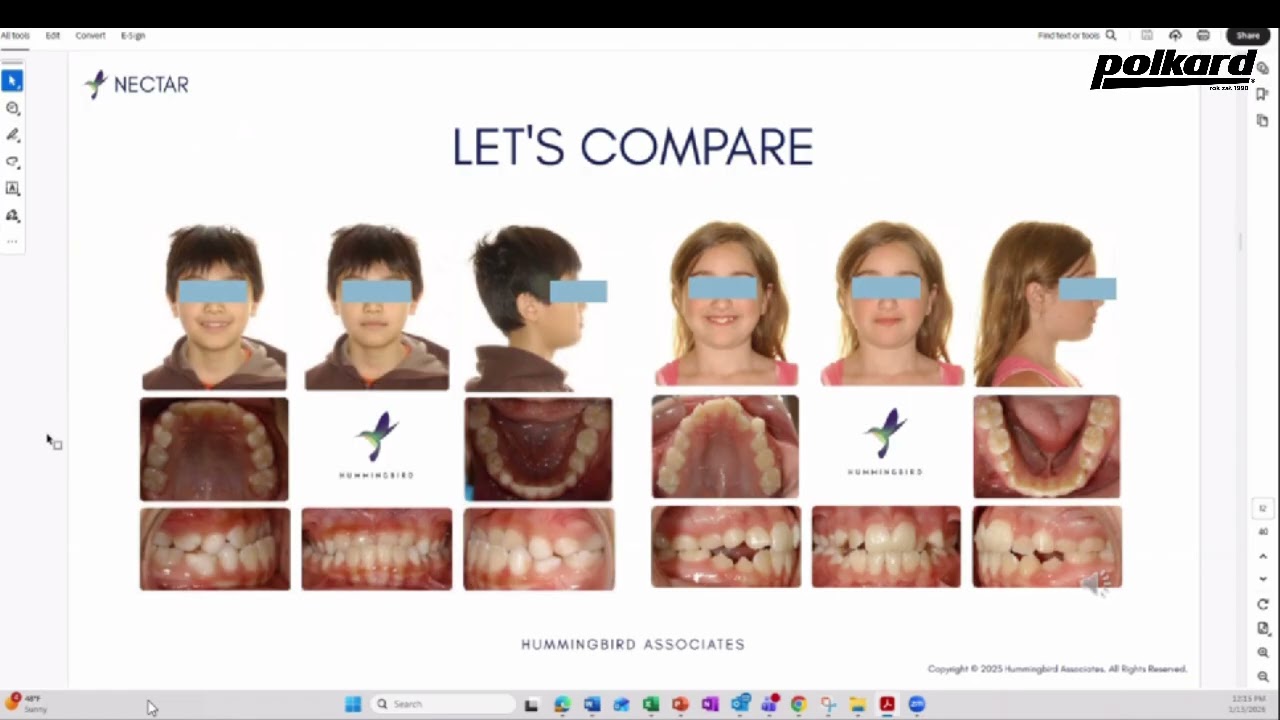 Webinar Navarro&Nelson: A Simple, Predictable Orthodontic Protocol: shorten &  standardise treatment