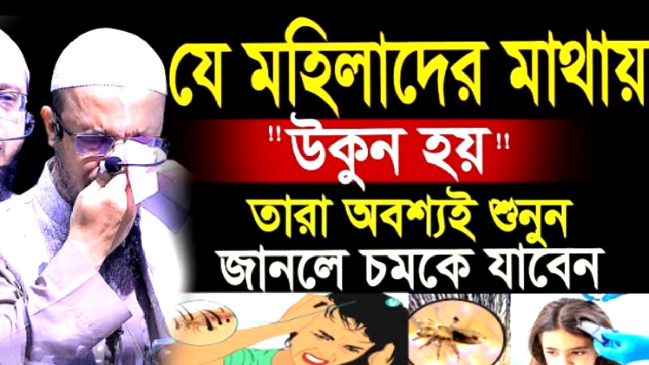 যে মহিলাদের মাথায় উকুন হয় তারা অবশ্যই শুনুন জানলে চমকে যাবেন ! আহমাদুল্লাহ ! Shaikh Ahmadullah