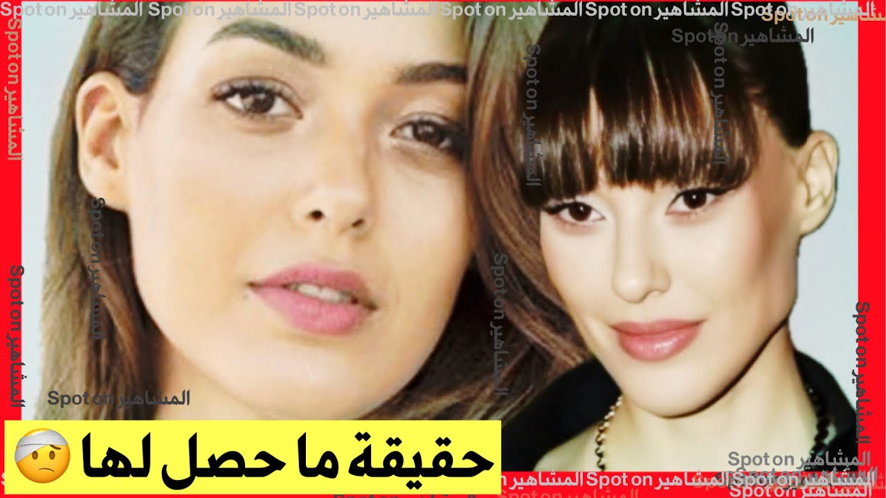 Неудачная пластическая операция Дилана Дениза! Экстремальная потеря веса, лицо, изменившееся навсегд