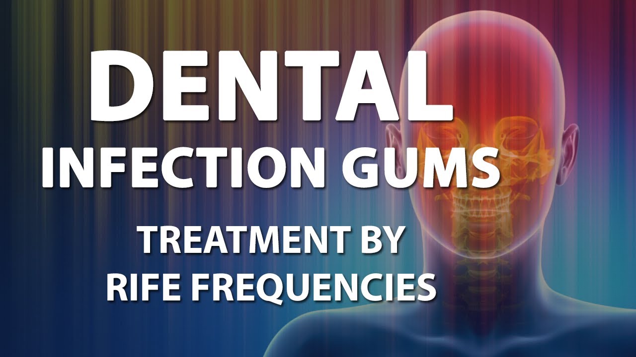 Dental Infection Gums - RIFE Frequencies Treatment - Energy & Quantum Medicine with Bioresonance