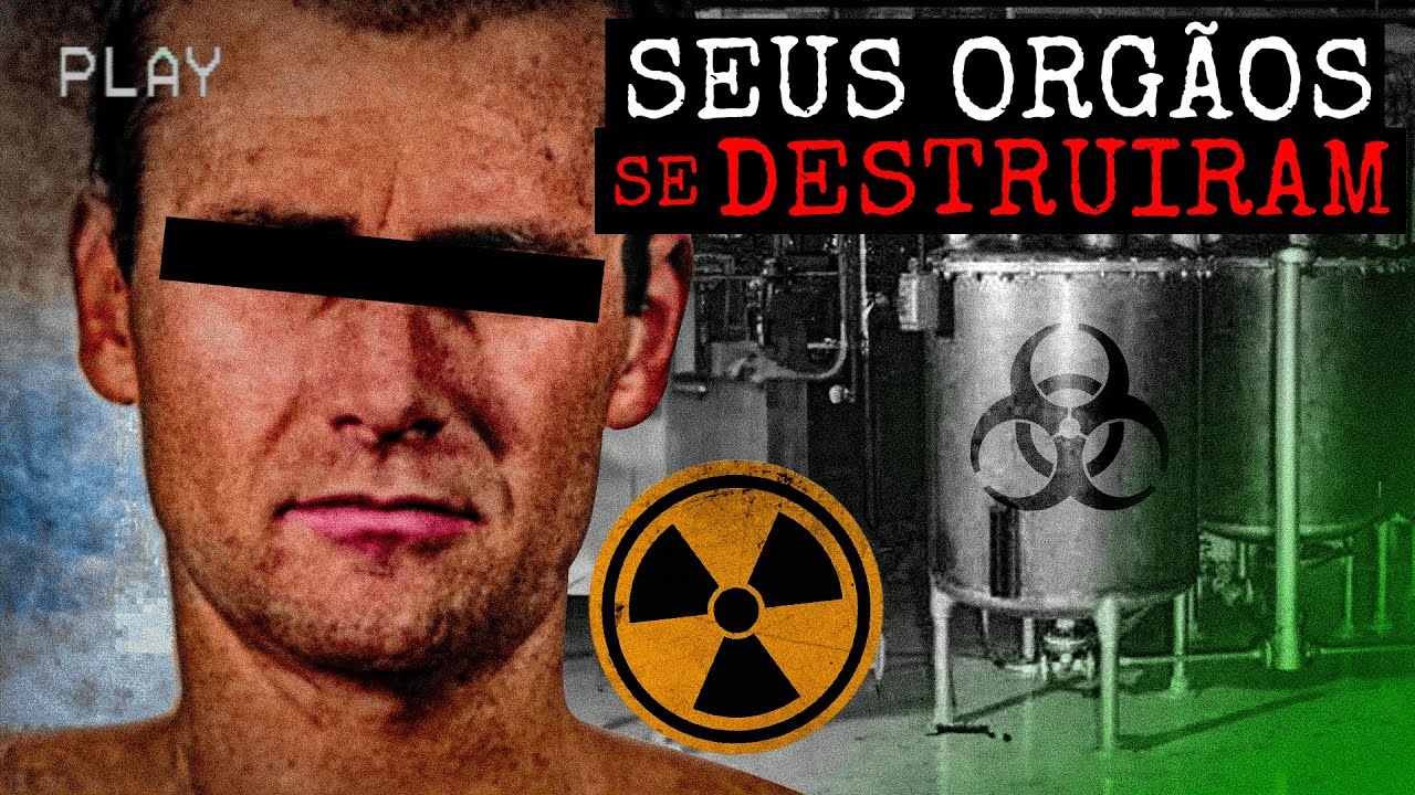 Ele Sofreu Um Dos Piores Acidentes Nucleares Da Hist&oacute;ria - Cecil Kelley
