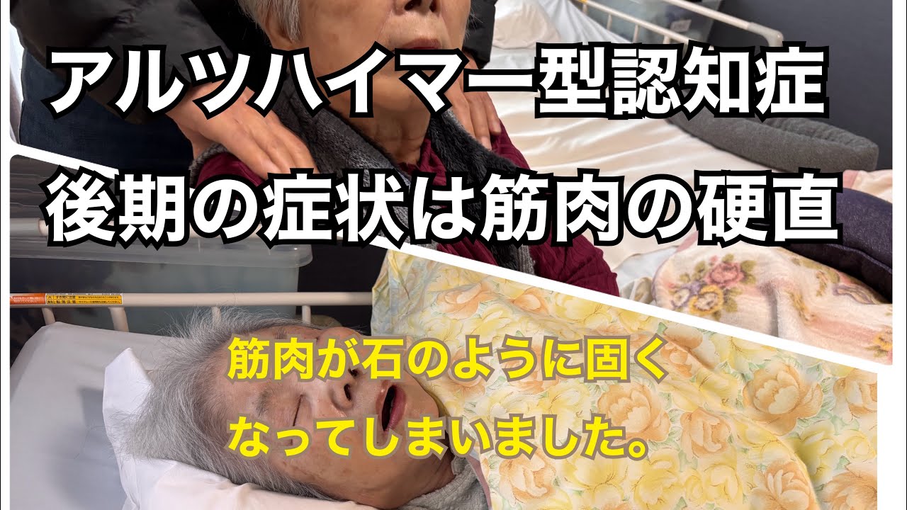 認知症と戦います！74 アルツハイマー型認知症後期症状2