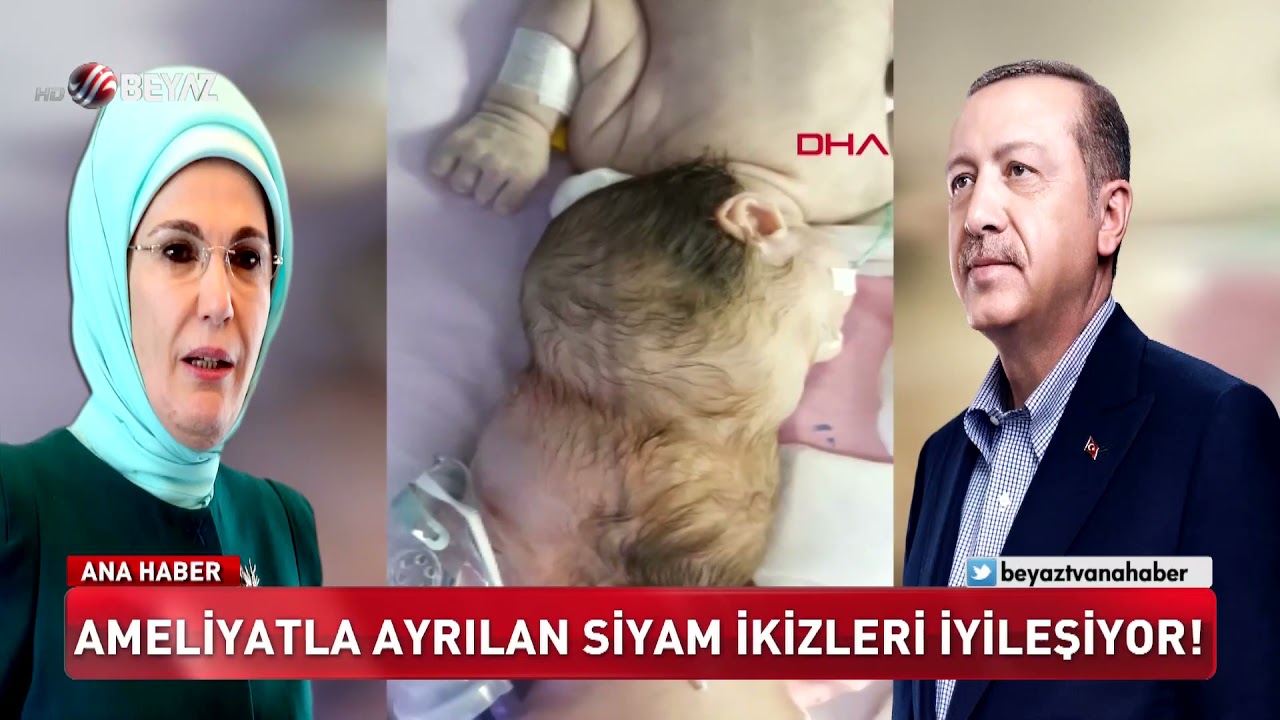 Mucize ikizler Derman ve Yiğit 3 yaşında!