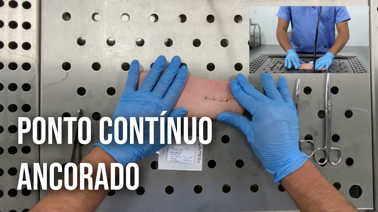 Sutura Contínua Ancorada - Livro Princípios de Cirurgia e Anestesia