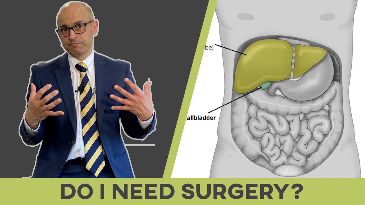 Почему мне нужна операция для лечения желчных камней?