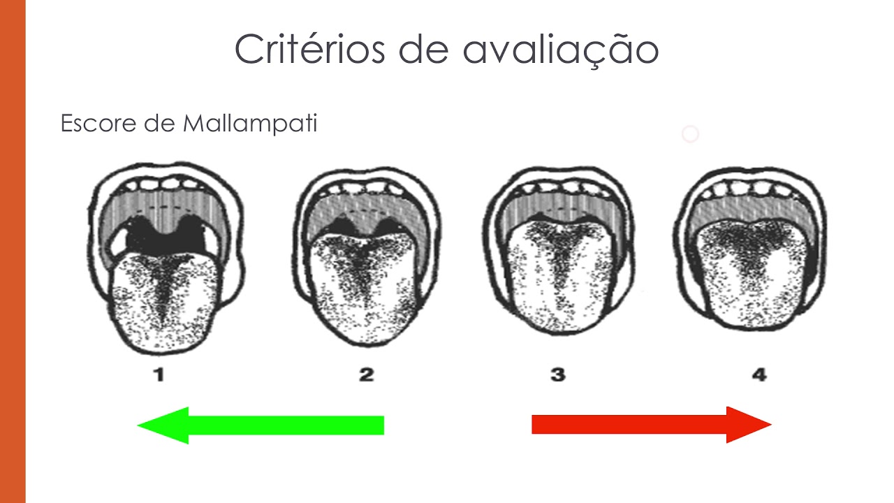Via Aérea Difícil e Uso de Dispositivos