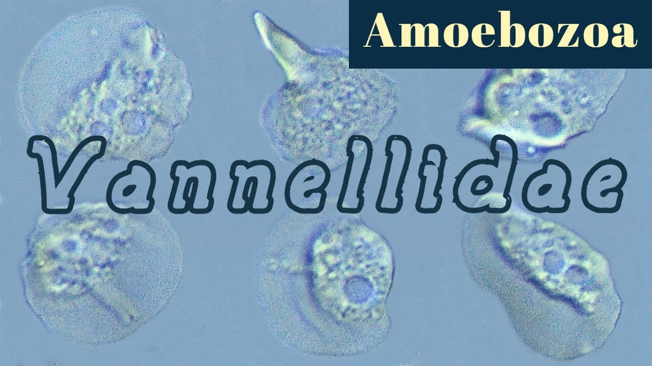 Vannellidae. Naked lobose amoeba in a locomotive form (Amoebozoa)
