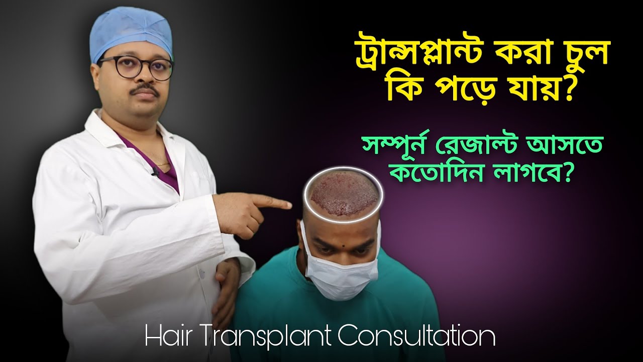 ট্রান্সপ্লান্ট করা চুল কি পড়ে যায় ? Best Hair Transplant Clinic in Kolkata | FUT FUE Result