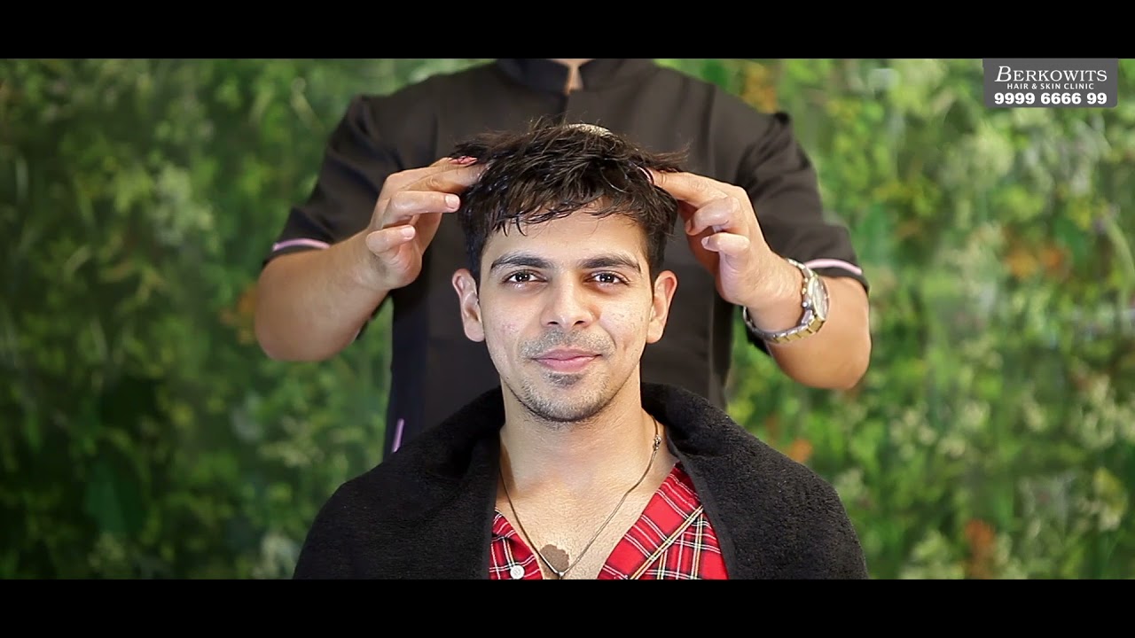 Berkowits Non Surgical Hair Replacement Service - Its Magic