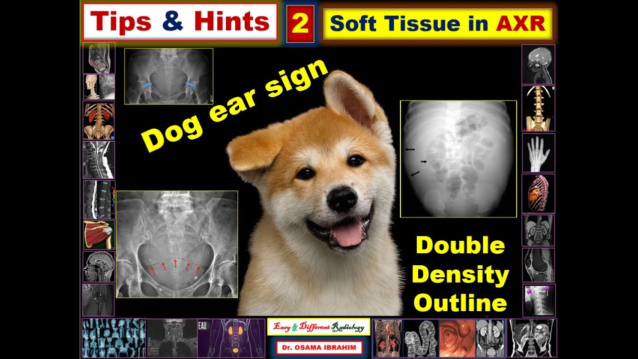 Tips and Hints (2) AXR ascites