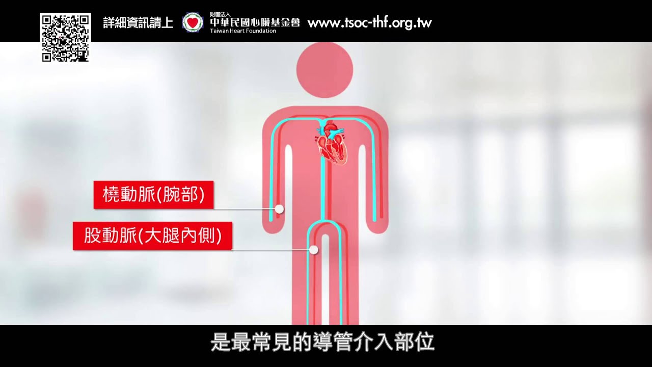 冠心病小學堂part5 – 心導管手術的介紹