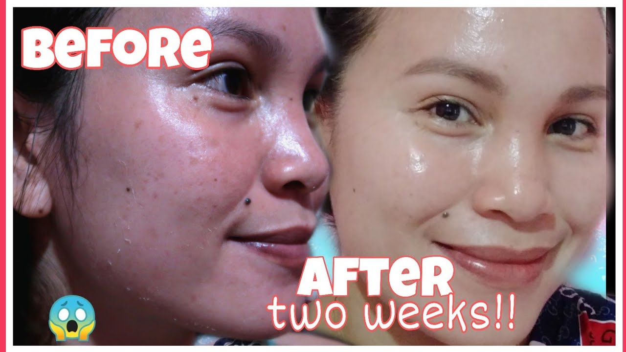 GLASS SKIN IN JUST 2 WEEKS!I TRIED BEAUTY VAULT REJUVENATING SET AND THIS IS WHAT HAPPENED😱