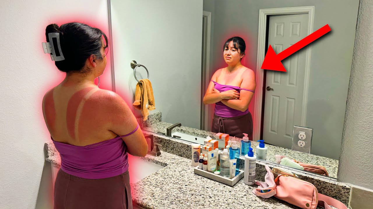My Wife Got The Worst Sunburn Ever! 🥵