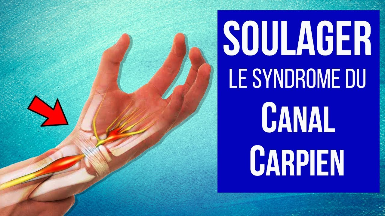 Soulager le syndrome du canal carpien : Les traitements