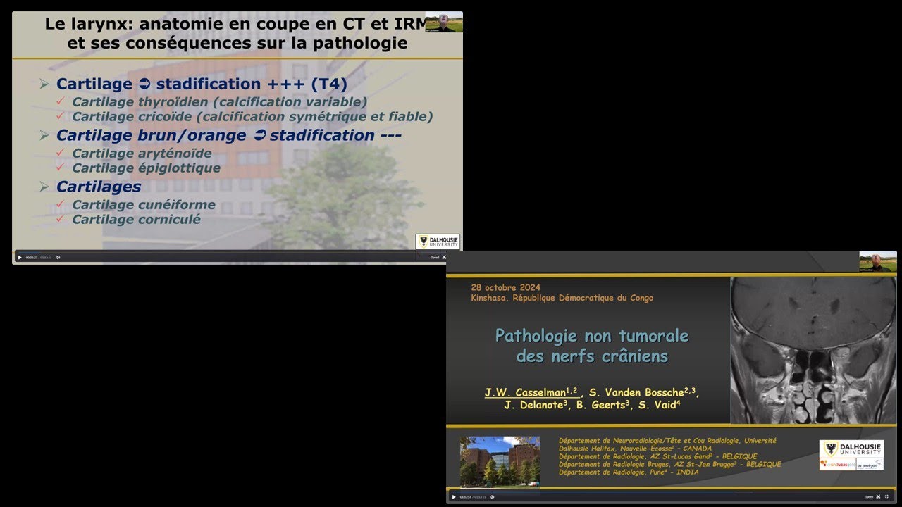 Anatomie et pathologie du larynx & pathologies non tumorales des paires des nerfs crâniens